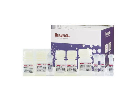Prueba ambiental del kit de extracción de ácido nucleico de aguas residuales BeaverBeadsTM