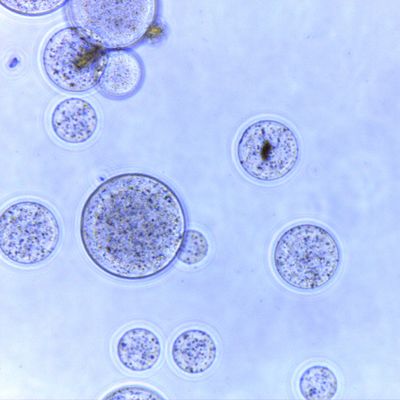 150 ratio magnético del volumen de la purificación 10% de la proteína de las gotas del μm 5 ml